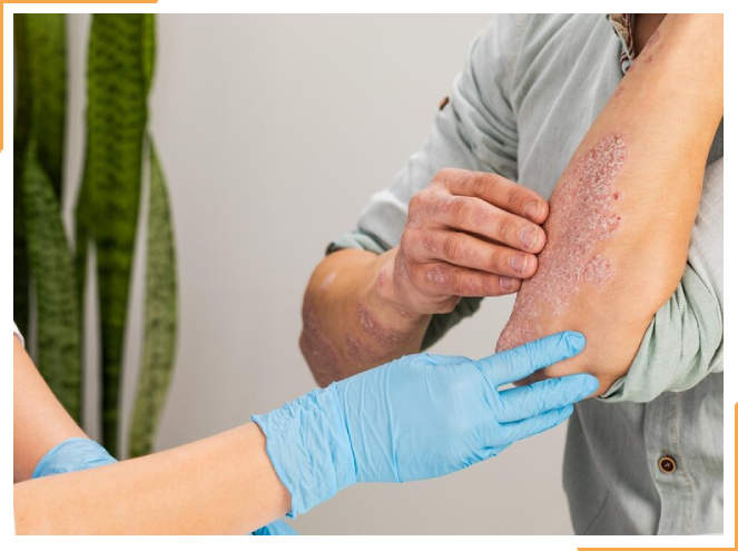 psoriasis patient seeing a dermatologist about a skin rash that looks like psoriasis